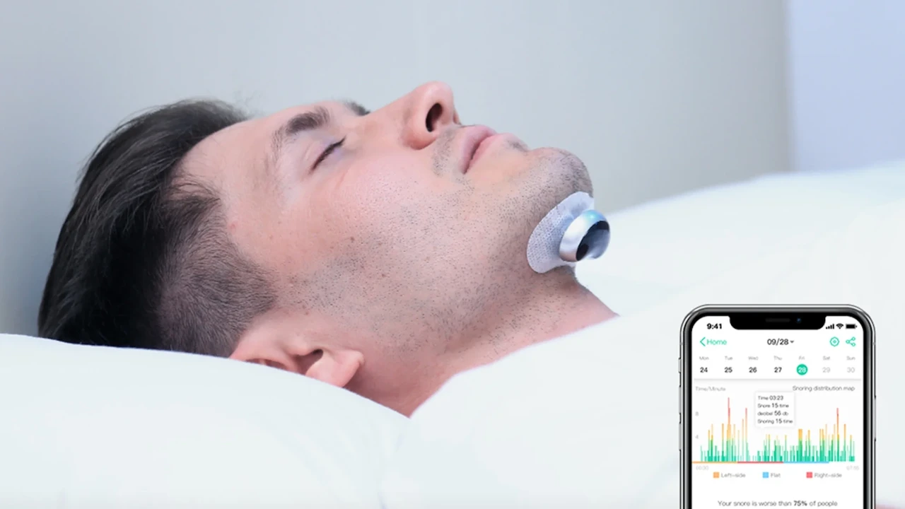 Close up on a plate of mashed potatoes, topped with baked pork chops with cream of mushroom soup, and a side of green beans.